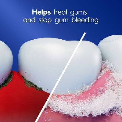 Crest Pro-Health Gum Detoxify Deep Clean Toothpaste 4.8oz/3pk - Imperfect Box